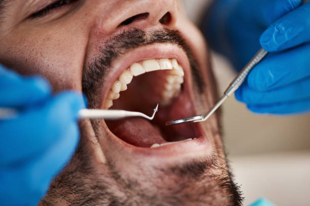 Best Emergency Dental Care  in Newton, MS